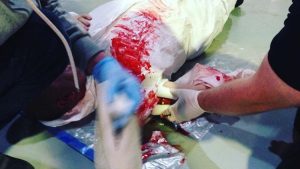 GWO First Aid Refresher